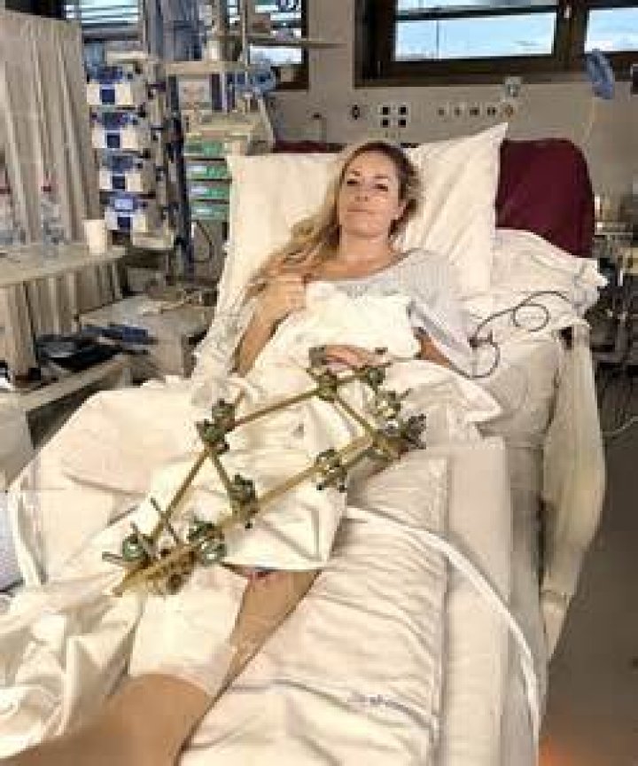 Paula Newsome's Leg Injury And Inspiring Recovery