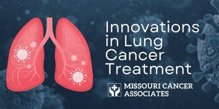 Uncovering Hope And Advancements In Lung Cancer