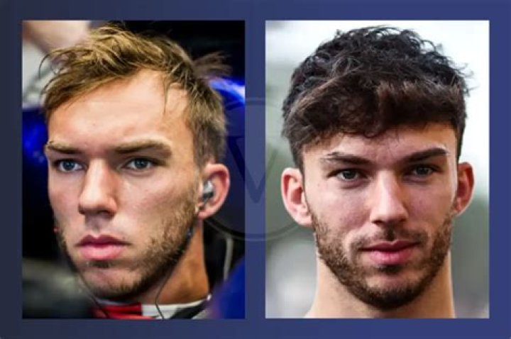 Unveiling The Secrets Of "Gasly Hairline": Discoveries And Insights Revealed